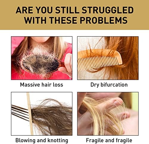 Удебеляване на Загубата е По-Гъста косата на жените по-Бързо Балсам за коса -Hair Hair100ml Шампоан за коса Promote и и Мъжки