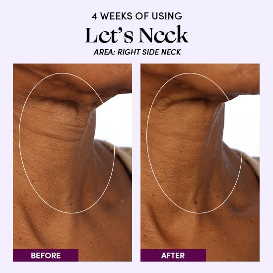 Комплект за укрепване на кожата в периода на менопаузата Womaness - Серум против бръчки Let ' s за шията